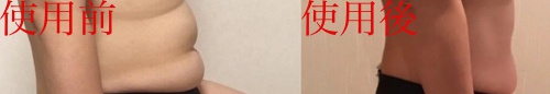 ダイエット ビフォーアフター
